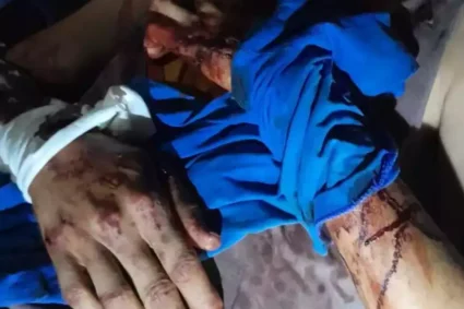 Tragédia no Pantanal: Jovem de 28 Anos é Atacado por Onça-Pintada Neste Sábado (04) em Corumbá