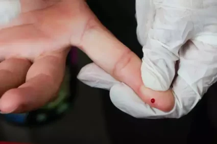 SUS passa a oferecer teste rápido para diagnóstico da dengue em todo o Brasil