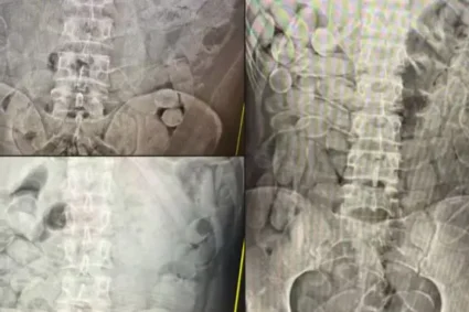 Corumbá é apontada como rota estratégica do tráfico internacional: cidade é usada para envio de cocaína ao Brasil e ao exterior